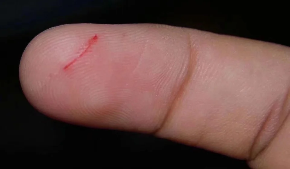 为什么有时会觉得被纸割伤的手，比刀子划伤还要疼？